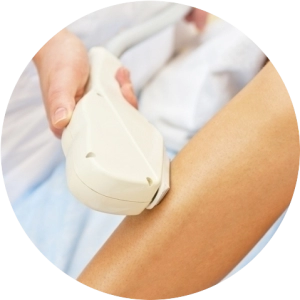 Лазерная эпиляция ног